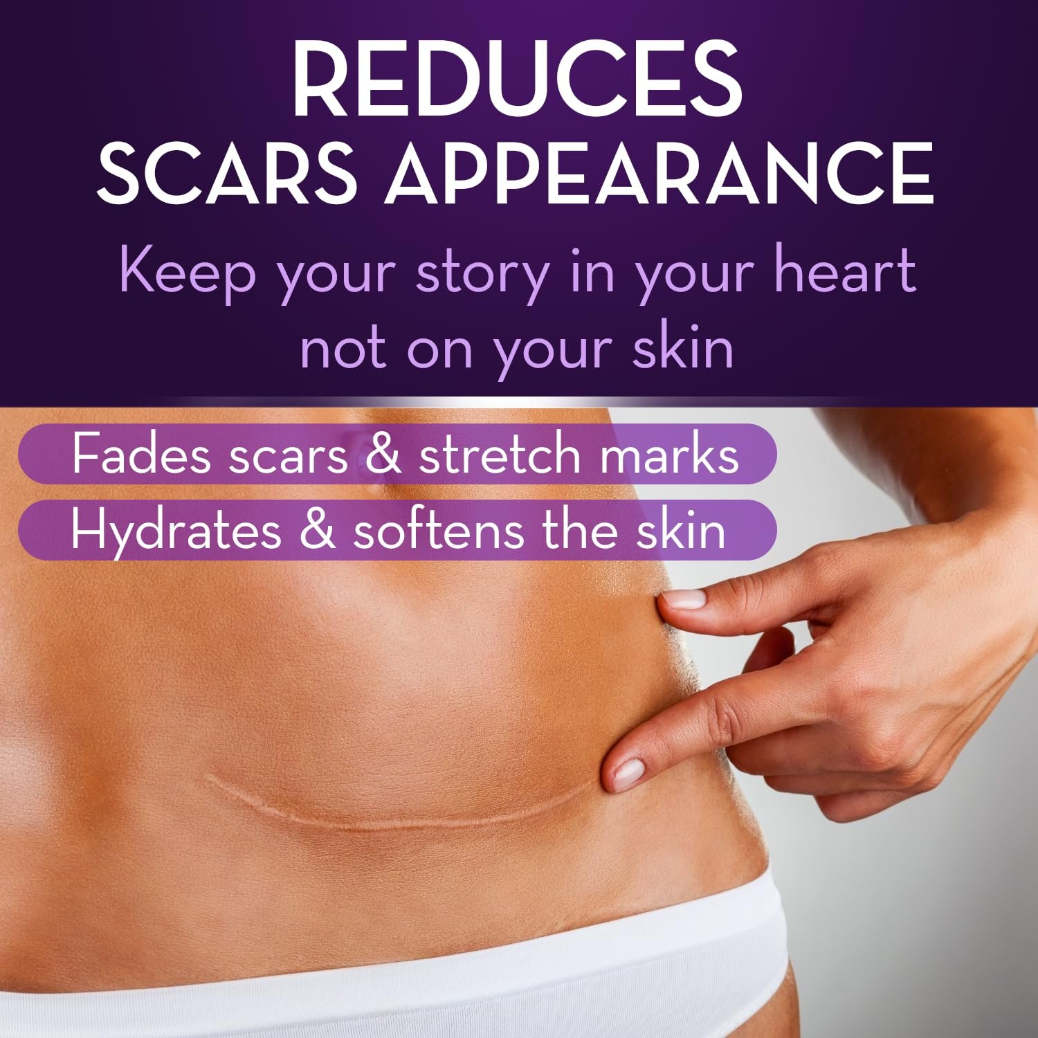 Cicatricure-Advanced-Scar-Gel-for-Face-Body-Proven-Results-in-2-Weeks-Scar-Treatment-for-Surgical-Scars-Stretch-Marks-Scars-of-Burns-and-Injuries-Acne-Scar-Treatment-1-oz-28-g.jpg