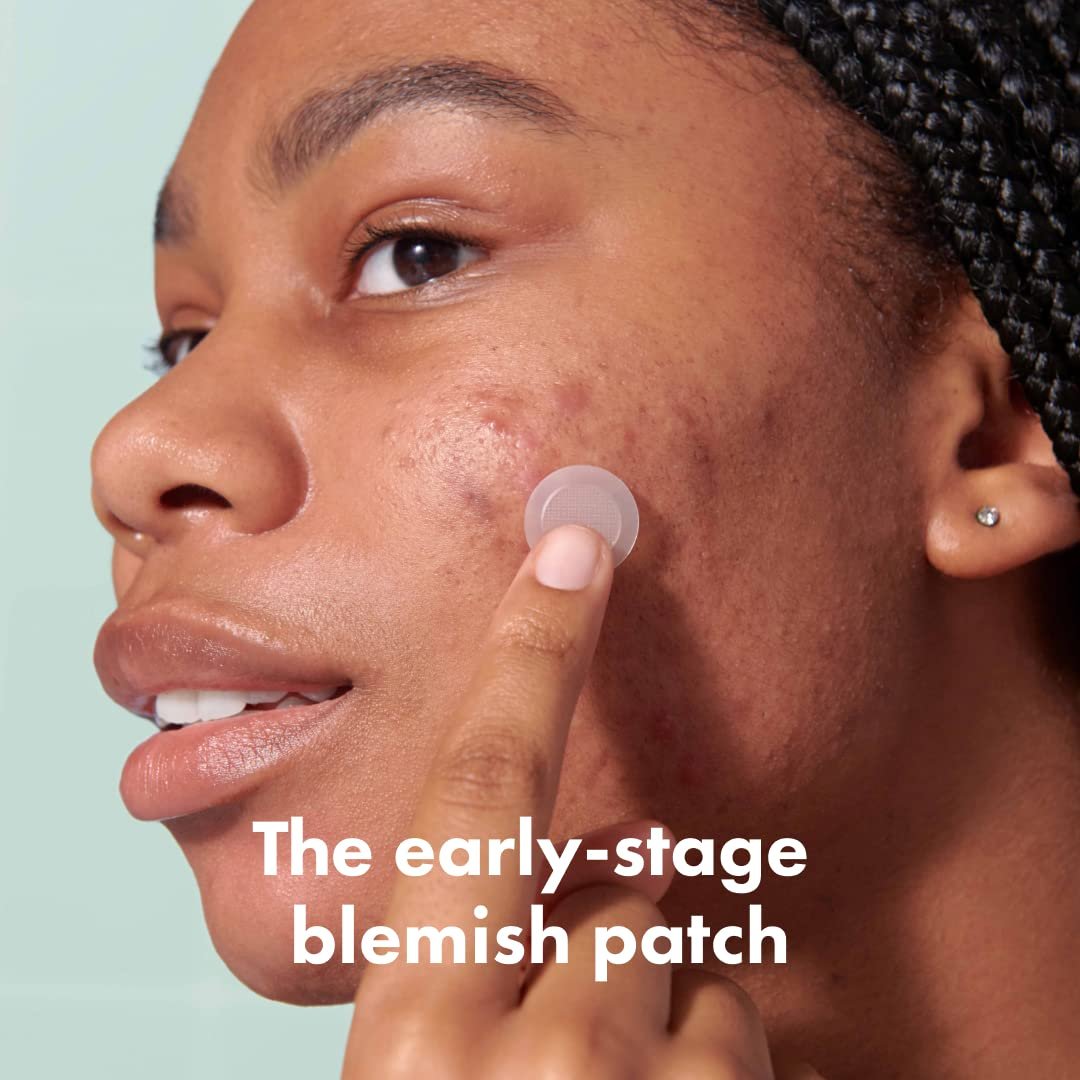 Mighty-Patch-Micropoint™-for-Blemishes-from-Hero-Cosmetics-Hydrocolloid-Acne-Spot-Treatment-Patch-for-Early-Stage-Zits-and-Hidden-Pimples-395-Micropoints-8-Patches.jpg