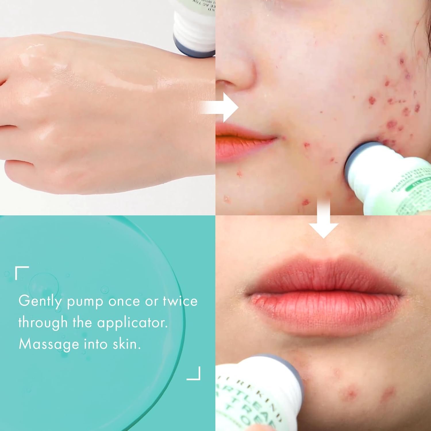 1756762643_Heartleaf-Tea-Tree-Tok-Acne-Treatment-Soothing-Toner-Serum-Centella-Asiatica-Korean-Facial-Skincare-for-Pore-Control-Calming-Nourishing.-50ml-1.69-fl.-oz.jpg