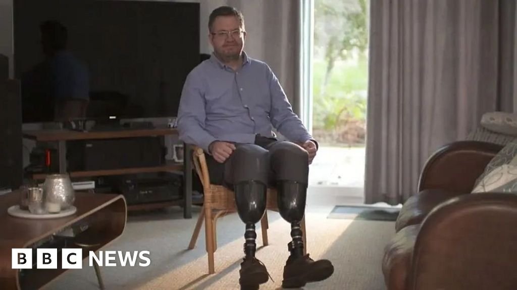 Surgeon Neil Hopper jailed after amputation of own legs