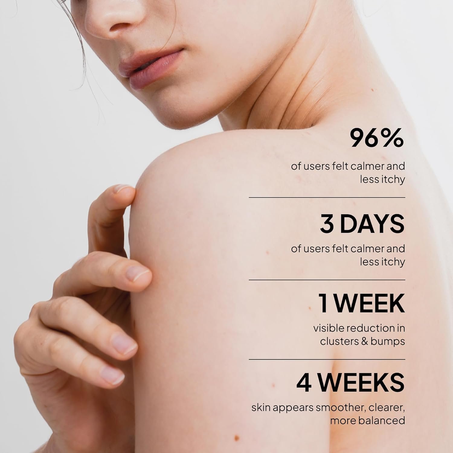 1761612051_Fungal-Acne-Treatment-Lotion-Effective-Face-Body-Pimple-Cream-for-Bumps-Clusters-Itch-Redness-–-Fungal-Prone-Skin-Acne-Treatment-Moisturizer-for-Teens-Adults-with-Natural-Actives.jpg
