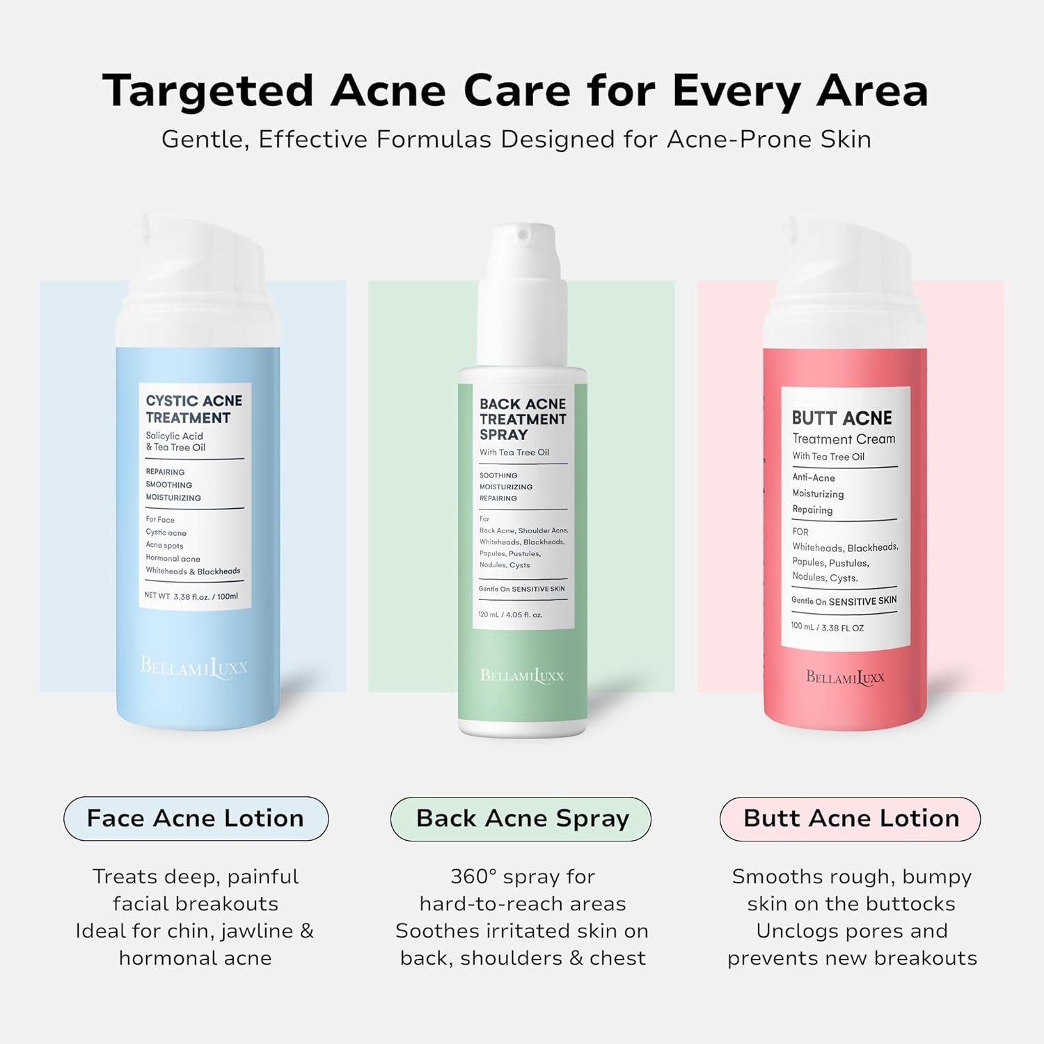 1761612055_Fungal-Acne-Treatment-Lotion-Effective-Face-Body-Pimple-Cream-for-Bumps-Clusters-Itch-Redness-–-Fungal-Prone-Skin-Acne-Treatment-Moisturizer-for-Teens-Adults-with-Natural-Actives.jpg