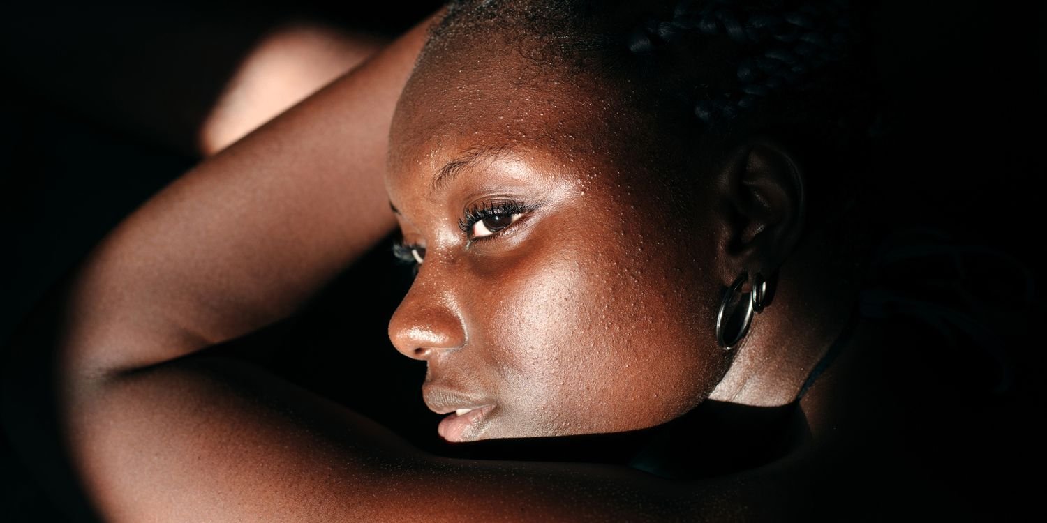 8 Lasers Safe for Deeper Skin Tones, According to Dermatologists