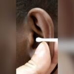 Should we be using cotton buds to clean our ears?